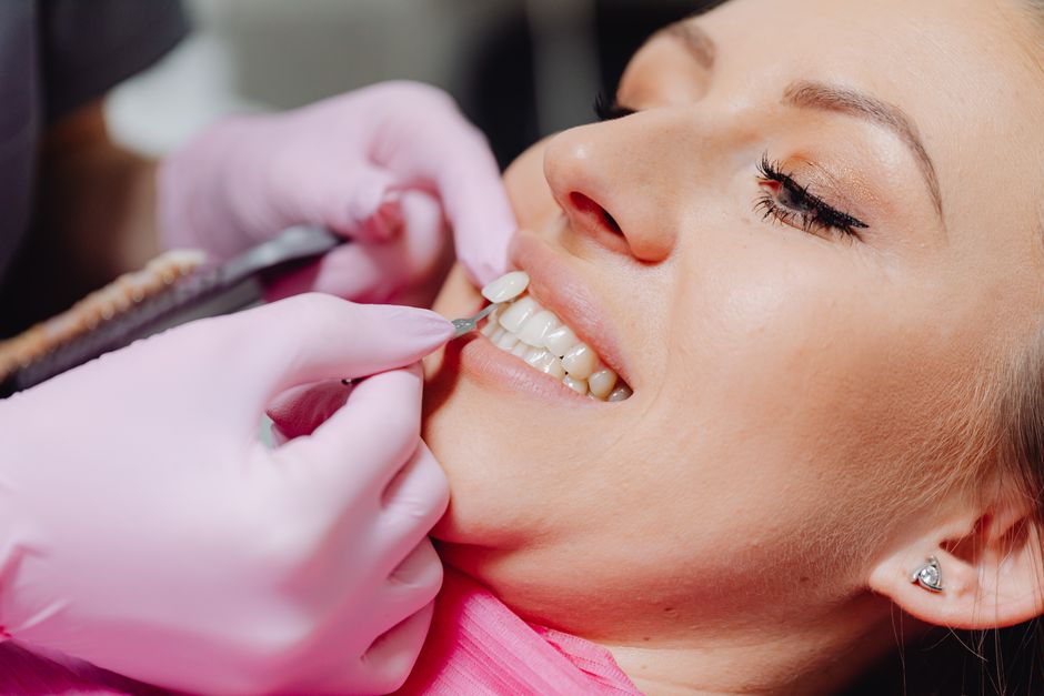Can I Whiten My Teeth With Crowns, Fillings, Veneers, or Gum Problems?